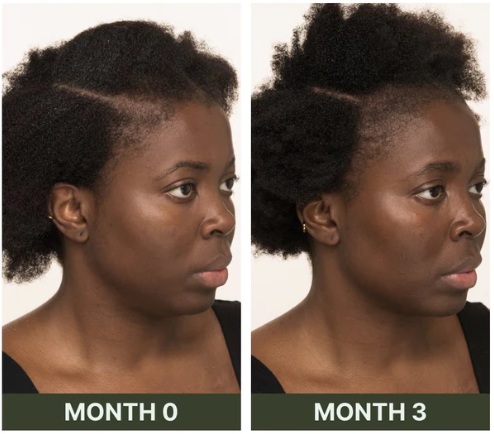Introducing Our Award Winning Scalp Serum