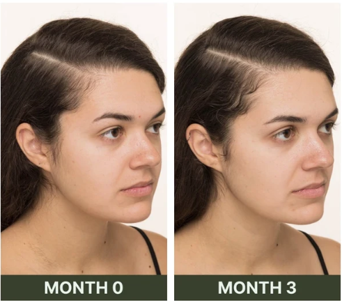 Introducing Our Award Winning Scalp Serum